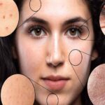 best creams for pigmentation